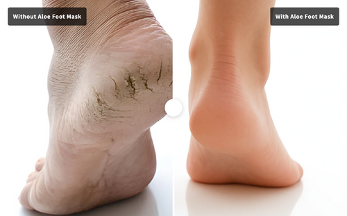 Aloe Foot Mask