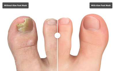 Aloe Foot Mask