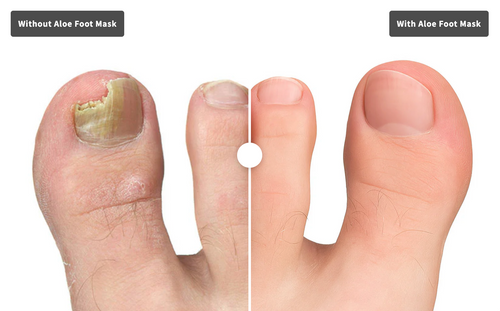 Aloe Foot Mask